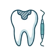 Dental Fillings